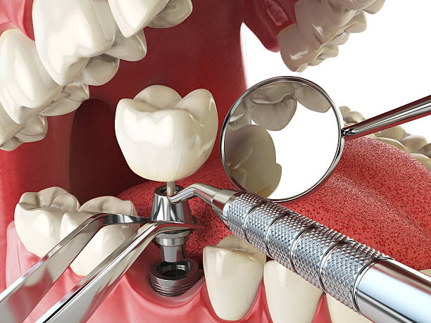 Best Emergency Care for Gum Disease in Wixom, MI